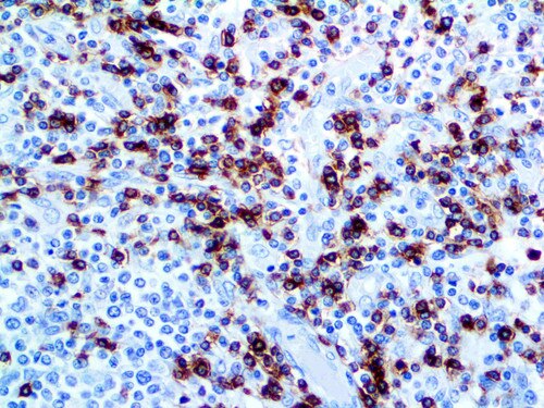IHC of CD7 on an FFPE Tonsil Tissue